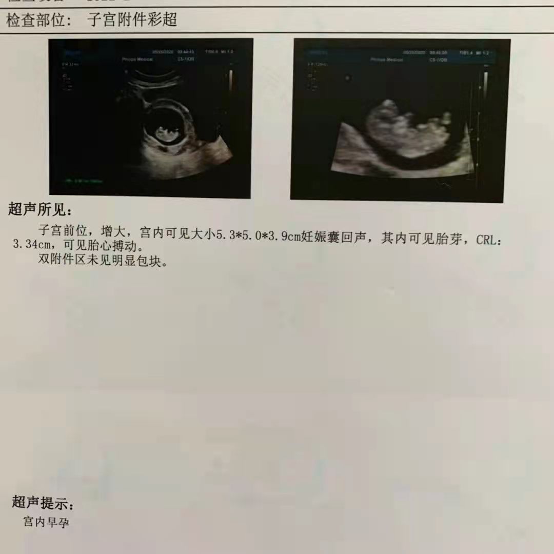 苏州妇产孕检报告